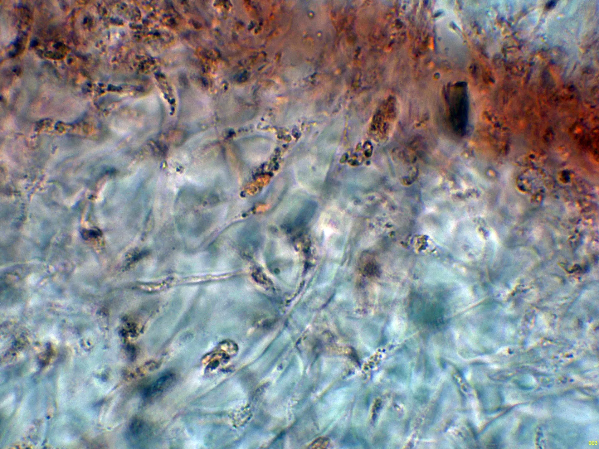 Microscopía de Hysterangium coriaceum - 10 - Hifas peridio interno-003